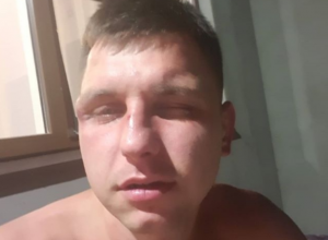 Избит у дома: Поплатился лицом за правду краснодарский блогер Ширманов Избит у дома: Поплатился лицом за правду краснодарский блогер Ширманов