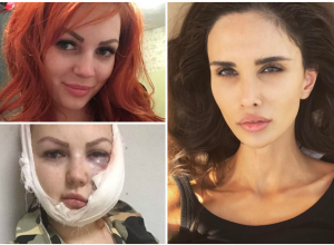 Жена игрока ФК «Краснодар» Алана Мамаева решила помочь изуродованной девушке из Апшеронска Жена игрока ФК «Краснодар» Алана Мамаева решила помочь изуродованной девушке из Апшеронска