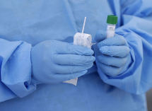 В Краснодарском крае за сутки зарегистрировали 466 случаев заболевания COVID-19