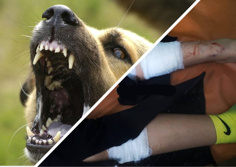 Прокуратура проверяет факт нападения собак на девочку в Краснодаре