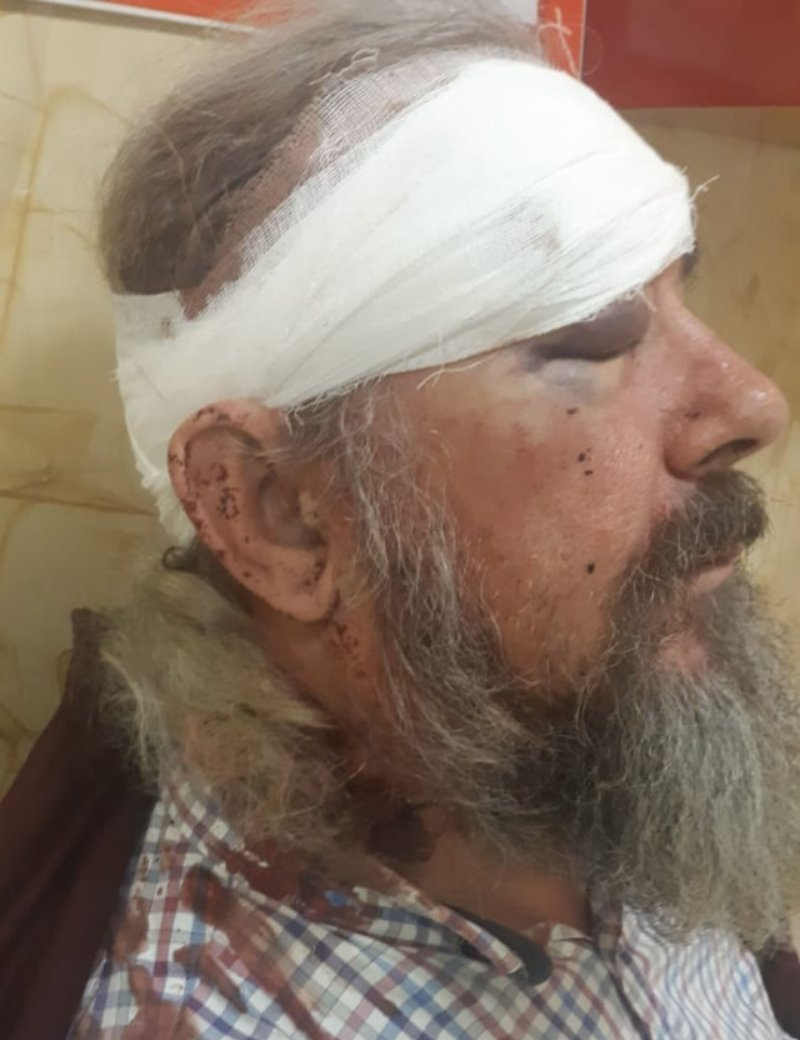 Инвалида, избитого полицейским на Кубани за отказ надеть маску, наказали за неповиновение